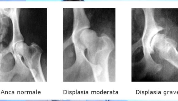 Displasia dell’anca nel cane